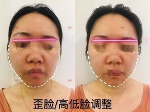 (魔力v脸保持多久)揭秘魔力V脸的秘密：打造完美轮廓的美容秘诀与实用技巧