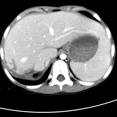 (异环磷酰胺作用是什么)《异环》即将登陆全球各大平台，引发全球热潮